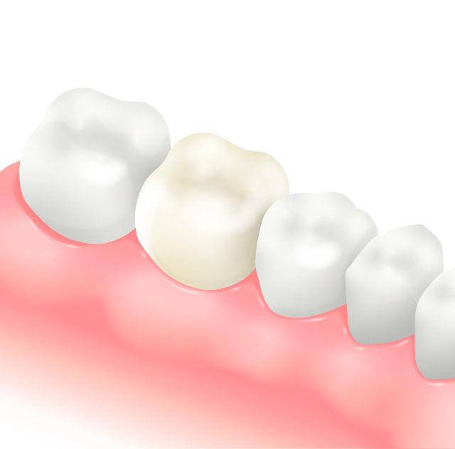 emaxのイラスト