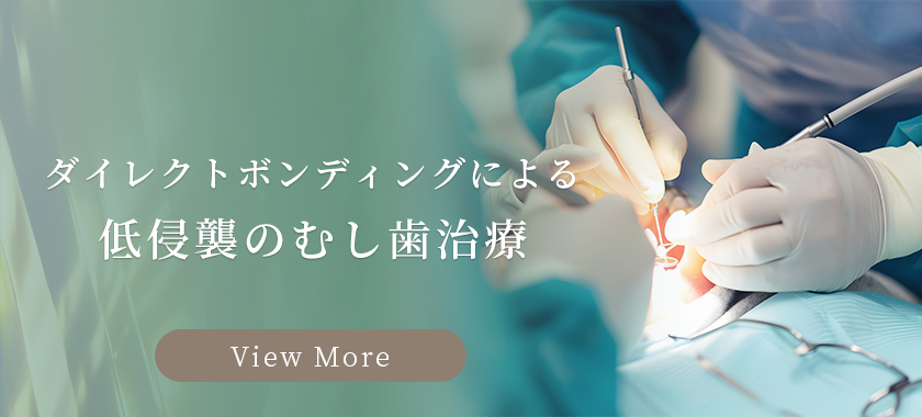 ダイレクトボンディングによる低侵襲のむし歯治療 バナー
